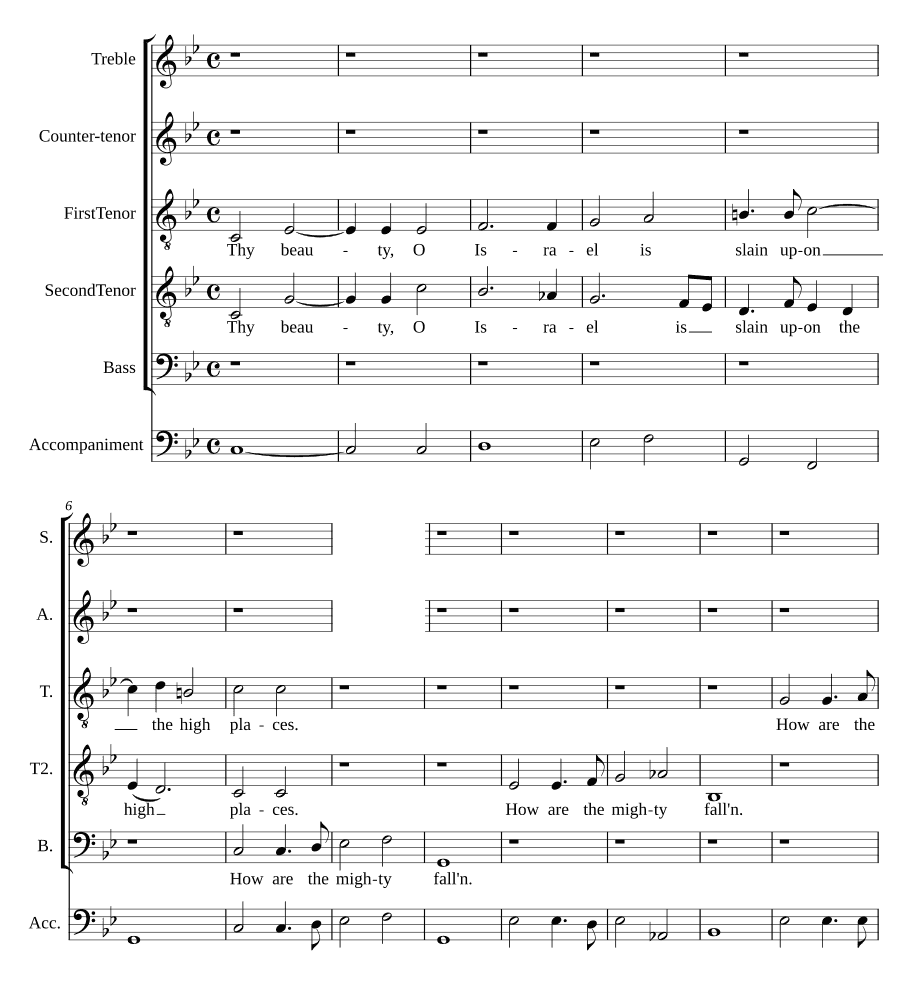 Твоя красота, Израиль (Thy beauty, O Israel)