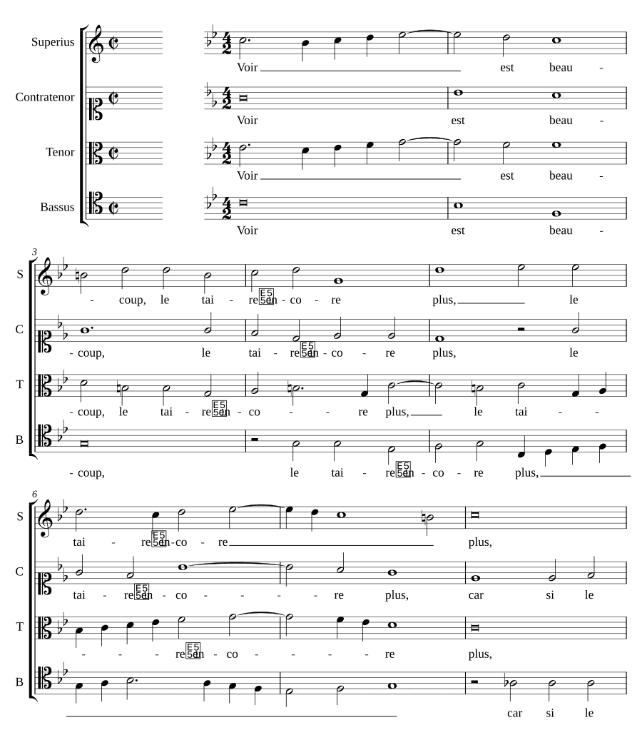 Видеть — это многое (Voir est beaucoup)