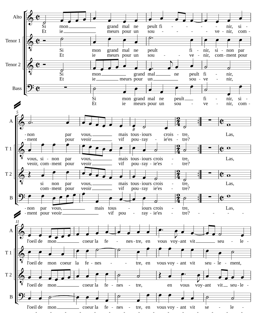Если моя великая боль (Si mon grand mal)